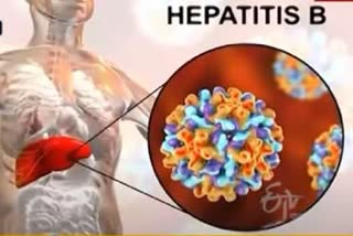 Hepatitis B