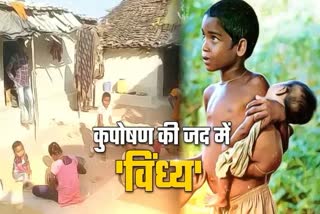 Malnutrition in Satna