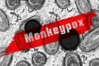with-those-vaccines-dot-dot-dot-new-monkeypox-can-be-prevented