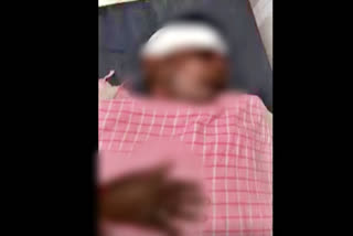 Bihar: Husband burnt, blinded after wife throws acid at him over Rs 2,000