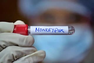 Nigerian woman tests positive for monkeypox in Delhi, India's tally rises to 13