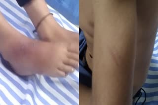 Etv Bharatboy-assaulted-by-madrasa-teacher-in-dakshina-kannada