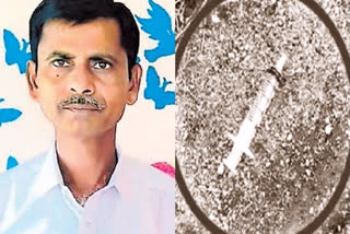 Telangana Police claim to have solved sensational the murder 48-year-old man who was administered a lethal dose of an unspecified chemical with the scientific evidence pointing to the involvement of the deceased's spouse and her paramour.