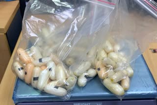 Ethiopian arrested at Bengaluru Airport by Customs, 104 coke capsules found in stomach