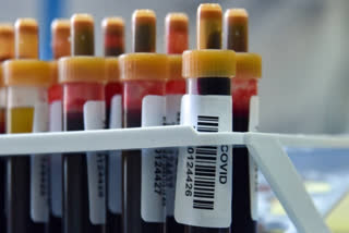 Simple blood test with AI help can predict who will get long Covid