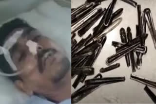 Doctors remove 63 steel spoons  Doctors removes steel spoons UP man stomach  UP Doctors removes steel spoons from drug addicts  ഉത്തര്‍പ്രദേശിലെ മുസാഫർനഗര്‍ സ്വദേശി  native of Muzaffarnagar Uttar Pradesh  വയറ്റില്‍നിന്നും നീക്കിയത് 63 സ്‌പൂണുകള്‍