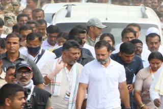 dk-shivakumar-got-injured-to-his-hand-during-delhi-visit