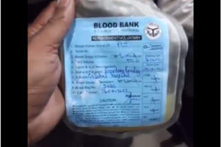 Dengue Patient dies after allegedly given 'mosambi Juice' instead of blood Plasma in UP's Prayagraj, govt orders probe