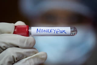 monkeypox disease in children