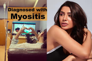 Samantha talks about battling Myositis