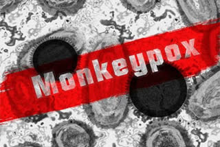 Monkeypox risk in Children 8 year old or younger