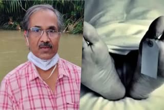 krishnamoorthi death arrest  Dental Doctor krishnamoorthi death  ദന്ത ഡോക്‌ടറുടെ ആത്‌മഹത്യ  പീഡനാരോപണത്തില്‍ പല ദുരൂഹതകളും  ബദിയെടുക്കയിലെ ദന്ത ഡോക്‌ടർ കൃഷ്‌ണമൂർത്തി  ദന്ത ഡോക്‌ടർ മരണത്തിലെ അറസ്‌റ്റ്  കാസര്‍കോട് വാര്‍ത്തകള്‍  Kasaragod news