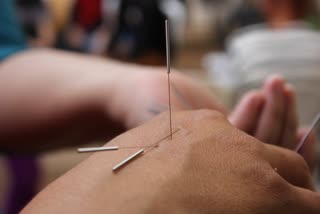 Know the history of World Acupuncture Day