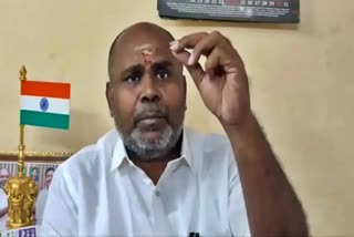 cable TV customers  private  RB Udayakumar  கேபிள் டிவி வாடிக்கையாளர்கள்  கேபிள் டிவி  ஆர் பி உதயகுமார்  அரசு  எதிர்க்கட்சித் துணைத் தலைவர்  தனியாருக்கு மடைமாற்றம்  எடப்பாடி பழனிச்சாமி  ஜெயலலிதா  முன்னாள் முதலமைச்சர்  முதலமைச்சர்  செட்டாப் பாக்ஸ்கள்