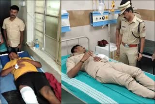 police force firing on robber  police force shootout on robber  police shootout case in Bengaluru  ಪೊಲೀಸರಿಂದ ದರೋಡೆಕೋರನ ಮೇಲೆ ಫೈರಿಂಗ್  ಕುಖ್ಯಾತ ದರೋಡೆಕೋರನ ಮೇಲೆ ಪೊಲೀಸರು ಫೈರಿಂಗ್  ಕುಖ್ಯಾತ ದರೋಡೆಕೋರ ಯೋಗಾನಂದ ಗಾಯ  ಆರೋಪಿ ಪೊಲೀಸರ ಮೇಲೆ ಹಲ್ಲೆ