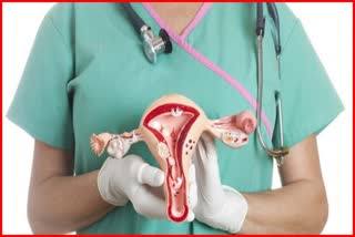 Increasing Trend of Hysterectomy in Indian Women