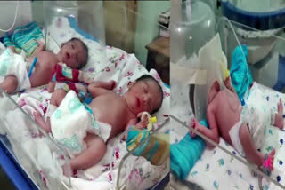 Woman Gave Birth to Three Babies