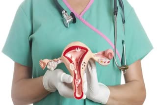 Health experts express concern over growing trend of uterus removal