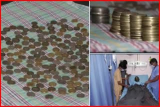 Doctors removed 187 coins from patient's body