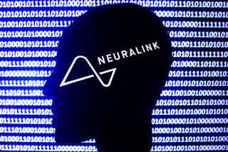 Musk's company aims to soon test brain implant in people