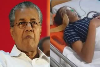 മേപ്പാടി  Aparna Gauri was beaten by UDF workers  aparna gauri  aparna gauri attack case  pinarayi vijayan  kerala latest news  kerala local news  വയനാട്  പിണറായി വിജയൻ  അപർണ ഗൗരി  അപര്‍ണ നേരിട്ടത് ക്രൂരമര്‍ദ്ധനം  മുഖ്യമന്ത്രി