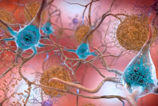 Harnessing the brain's immune cells to stave off Alzheimer's and other neurodegenerative diseases
