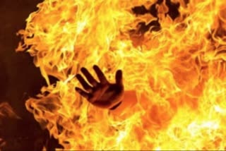 wife burnt her husband in a domestic dispute in Chatra