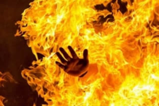 Wife burns husband due to domestic dispute in Jharkhand's Chatra