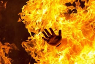 wife burnt her husband in a domestic dispute in Chatra