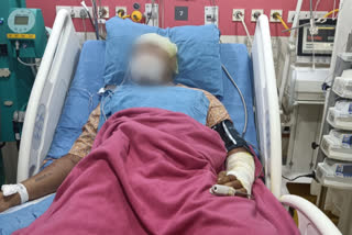 Madhya Pradesh: Doctors save life of bee-stung man with plasma exchange