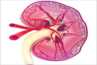 ABO Incompatible Kidney Transplantation procedure