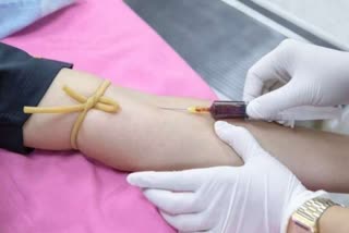 HIV infected blood injection