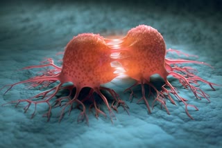 Etv Bharatજ્ઞાન નેત્ર : જાણો સ્તન કેન્સરના કોષોના જીદનું કારણ