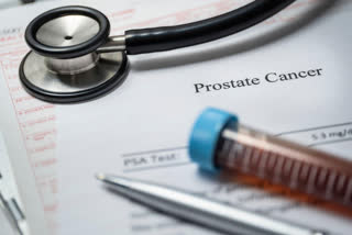 Study finds cells that helps to treat resistance in prostate cancer
