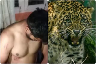 Leopard attacked the young man