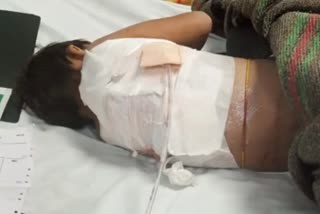 Stray dog injured girl in Jaipur