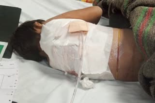 stray-dog-bite-girl-in-jaipur-admitted-in-hospital-now-stable