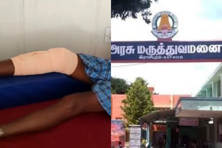 கண்ணாடி துண்டுகளுடன் காயத்திற்க்கு கட்டு