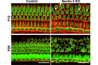 A checkerboard pattern of inner ear cells enables us to hear
