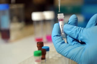 Genome Sequencing in Rajasthan begins, only omicron detected in 99 percent cases