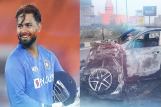 Rishabh Pant Health Updates