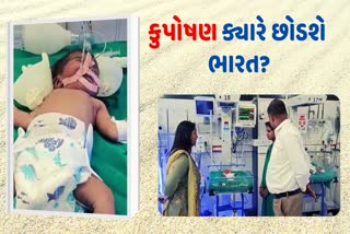 31 precent children born malnourished in one year surat