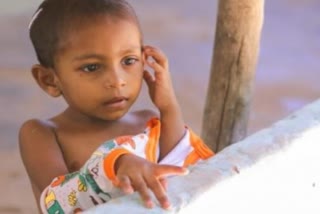سری لنکا کے 5 سال سے کم عمر بچوں میں غذائی قلت بڑھ رہی ہے