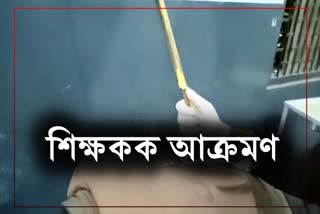 Teacher stabbed in the back by the miscreants in Barpeta