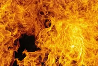 woman set on fire by husband