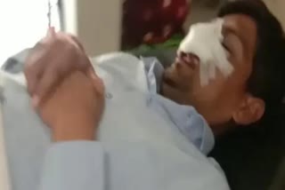 BJP leader suffered cuts to his nose and lips