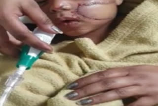 Child injured due to china door in Samrala