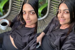 Mamta Mohandas diagnosed with Vitiligo  Mamta Mohandas  എനിക്ക് നിറം നഷ്‌ടപ്പെടുന്നു  വീണ്ടും അതിജീവിക്കാനുള്ള ശ്രമത്തില്‍ മംമ്‌ത  മേക്കപ്പില്ലാത്ത ചിത്രങ്ങള്‍ പങ്കുവച്ച് മംമ്‌ത  മംമ്‌ത  മംമ്‌ത മോഹന്‍ദാസ്  Mamta Mohandas has been diagnosed  Mamta Mohandas Instagram Post  Mamta Mohandas shares no make up selfies  Mamta Mohandas reveals her health issue  Comments on Mamta Mohandas post