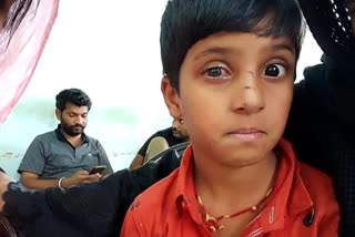 Victim Mohammad Ali with injured eye