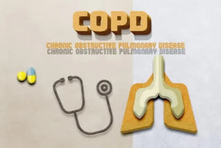 COPD patients are 61 per cent more likely to die within a year after major surgery